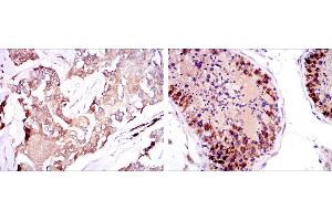 Immunohistochemistry (IHC) image for anti-Survival of Motor Neuron 1, Telomeric (SMN1) antibody (ABIN969408)