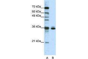 WB Suggested Anti-MSI2 Antibody Titration:  1. (MSI2 抗体  (N-Term))