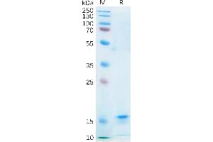Human IL21 Protein, His Tag on SDS-PAGE under reducing condition.