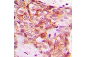 Immunohistochemistry (IHC) image for anti-Collagen, Type V, alpha 1 (COL5A1) (Center) antibody (ABIN7295326)