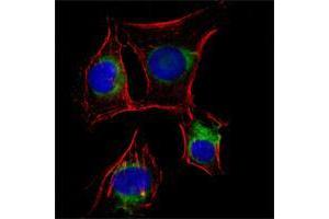 Immunofluorescence analysis of EC cells using NGFR mouse mAb (green). (NGFR 抗体)