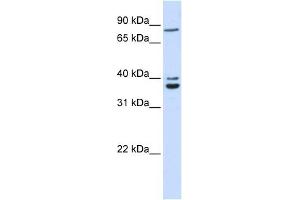 C18ORF10 antibody used at 1 ug/ml to detect target protein. (TPGS2 抗体  (Middle Region))
