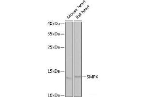 Western blot analysis of extracts of various cell lines using SMPX Polyclonal Antibody at dilution of 1:1000. (SMPX 抗体)