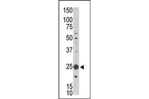 Western Blotting (WB) image for anti-Melanoma Antigen Family H, 1 (MAGEH1) (C-Term) antibody (ABIN358661) (MAGEH1 抗体  (C-Term))