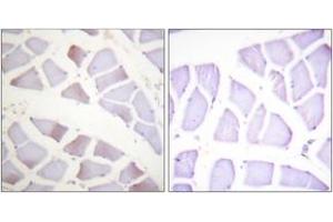 Immunohistochemistry analysis of paraffin-embedded human skeletal muscle, using CRYAB (Phospho-Ser19) Antibody.