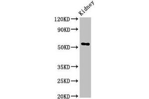 Western Blot Positive WB detected in: Rat kideny tissue All lanes: Fuca1 antibody at 3. (FUCA1 抗体  (AA 18-452))