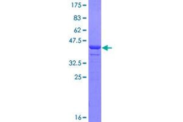 Fibulin 1 Protein (FBLN1) (AA 151-250) (GST tag)