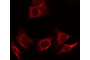 ABIN6278359 staining SW480 cells by ICC/IF. (MUC2 抗体)
