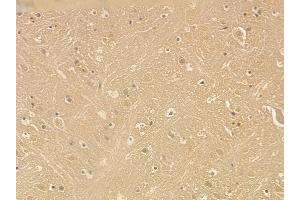 MAP2 Mouse Monoclonal Antibody at 1/100 staining mouse brain tissue by IHC-P. (MAP2 抗体  (C-Term))