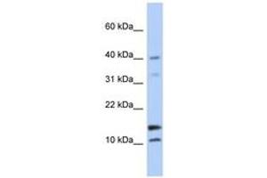 Image no. 1 for anti-WAP Four-Disulfide Core Domain 5 (WFDC5) (N-Term) antibody (ABIN6743675) (WFDC5 抗体  (N-Term))