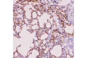 Immunohistochemistry (IHC) image for anti-Angiotensin I Converting Enzyme (Peptidyl-Dipeptidase A) 1 (ACE) (AA 651-864) antibody (ABIN3043777)