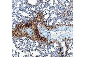 IHC analysis of Collagen III/COL3A1 using anti-Collagen III/COL3A1 antibody (ABIN6719295).
