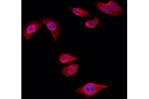 ABIN6258722 and ABIN6274757 staining Hela by IF/ICC. (RPS4Y1 抗体  (C-Term))