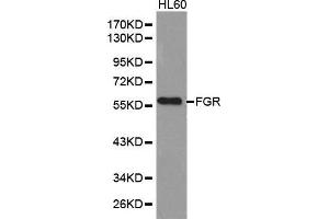 Western blot analysis of extracts of HL60 cell lines, using FGR antibody. (Fgr 抗体  (AA 1-100))