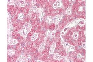 Anti-SIN1 antibody IHC of human liver. (MAPKAP1 抗体  (AA 100-150))