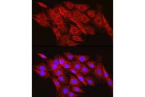 Immunofluorescence analysis of PC-12 cells using CPT2 Rabbit pAb (ABIN6129249, ABIN6138983, ABIN6138984 and ABIN6216045) at dilution of 1:100 (40x lens). (CPT2 抗体  (AA 1-180))