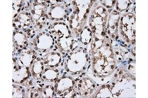 Immunohistochemical staining of paraffin-embedded lung tissue using anti-DAPK2 mouse monoclonal antibody. (DAPK2 抗体)