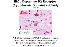 Image no. 1 for anti-Dopamine Receptor D2 (DRD2) (3rd Cytoplasmic Domain) antibody (ABIN1733733)