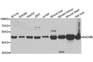 Western blot analysis of extracts of various cell lines, using HADHB antibody. (HADHB 抗体  (AA 34-270))