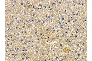 ABIN6258498 and ABIN6274470 at 1/100 staining mouse liver tissue by IHC-P. (ORCTL-2/SLC22A18 抗体  (C-Term))