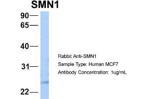 Western Blotting (WB) image for anti-Survival of Motor Neuron 1, Telomeric (SMN1) (N-Term) antibody (ABIN2778671)
