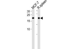 Western Blotting (WB) image for anti-CCHC-Type Zinc Finger, Nucleic Acid Binding Protein (CNBP) antibody (ABIN3001417)
