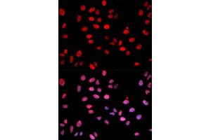 Immunofluorescence analysis of U2OS cell using Phospho-c-Jun-S243 antibody. (C-JUN 抗体  (pSer243))