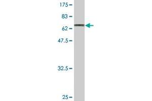 Western Blot detection against Immunogen (70. (Trnt1 抗体  (AA 1-405))