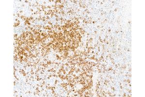 Immunohistochemistry (IHC) image for anti-CD5 (CD5) (AA 445-495) antibody (ABIN7454003)
