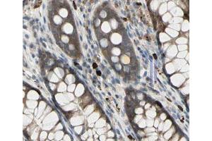 ABIN6268678 at 1/100 staining human colon tissues sections by IHC-P.