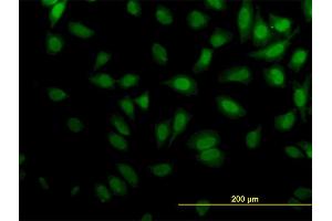 Immunofluorescence of monoclonal antibody to KPTN on HeLa cell. (KPTN 抗体  (AA 1-436))