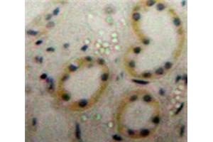 Immunohistochemistry (IHC) image for anti-Heat Shock 70kDa Protein 1A (HSPA1A) (AA 1-641) antibody (ABIN1078112)