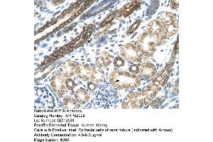 Rabbit Anti-KRT8 Antibody  Paraffin Embedded Tissue: Human Kidney Cellular Data: Epithelial cells of renal tubule Antibody Concentration: 4. (KRT8 抗体  (N-Term))