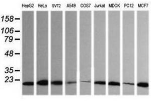Image no. 2 for anti-HRas proto-oncogene, GTPase (HRAS) antibody (ABIN1498714) (HRAS 抗体)