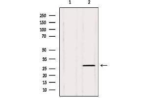 Western blot analysis of extracts from 3t3, using PHF19 Antibody. (PHF19 抗体  (Internal Region))