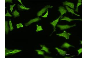 Immunofluorescence of monoclonal antibody to ZNF287 on HeLa cell. (ZNF287 抗体  (AA 231-330))