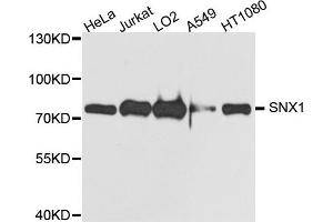 Western blot analysis of extract of various cells, using SNX1 antibody. (Sorting Nexin 1 抗体)