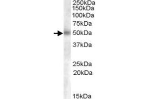 GCNT3 polyclonal antibody  (0. (GCNT3 抗体  (AA 273-284))