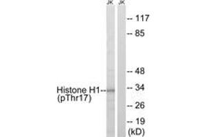 Western blot analysis of extracts from Jurkat cells treated with UV 15', using Histone H1 (Phospho-Thr17) Antibody. (Histone H1 抗体  (pSer17))