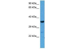 Western Blotting (WB) image for anti-Wingless-Type MMTV Integration Site Family, Member 3 (WNT3) (Middle Region) antibody (ABIN2783983)