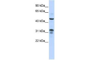 WB Suggested Anti-ZNF765 Antibody Titration:  0. (ZNF765 抗体  (N-Term))