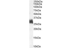 Image no. 1 for anti-FOS-Like Antigen 1 (FOSL1) (Internal Region) antibody (ABIN374695) (FOSL1 抗体  (Internal Region))