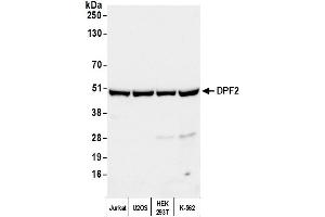 Western Blotting (WB) image for anti-Zinc finger protein ubi-d4 (DPF2) (AA 125-175) antibody (ABIN7451434)