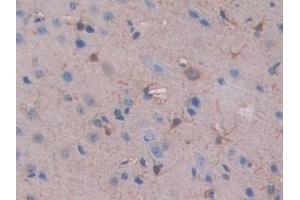 IHC-P analysis of Mouse Cerebrum Tissue, with DAB staining. (SLIT1 抗体  (AA 3-211))