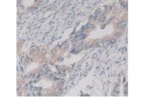 Figure. (TMEM27 抗体  (AA 17-137))