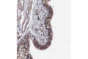 Immunohistochemical staining of human bronchus with RWDD4A polyclonal antibody  shows moderate cytoplasmic positivity in respiratory epithelial cells. (RWDD4A 抗体)