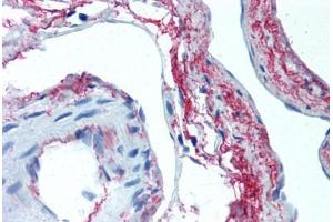 Human Skeletal Muscle, Vessels (formalin-fixed, paraffin-embedded) stained with ELN antibody ABIN305753 at 5 ug/ml followed by biotinylated anti-mouse IgG secondary antibody ABIN481714, alkaline phosphatase-streptavidin and chromogen. (Elastin 抗体)
