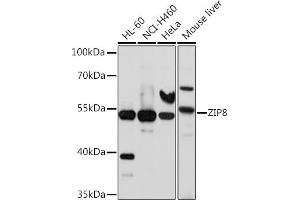 Western blot analysis of extracts of various cell lines, using ZIP8 antibody (ABIN6131079, ABIN6147995, ABIN6147996 and ABIN6214638) at 1:1000 dilution. (SLC39A8 抗体  (AA 180-300))