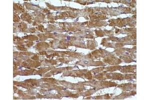 Rat hearttissue was stained by Angiotensin II (1-7) (Human) at 1:100 (AGT 抗体  (AA 1-7))
