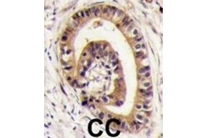 Immunohistochemistry (IHC) image for anti-Golgi-Associated PDZ and Coiled-Coil Motif Containing (GOPC) antibody (ABIN3003089) (GOPC 抗体)